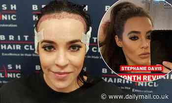 Stephanie Davis showcases her new hairline after revealing she underwent transplant surgery