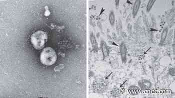 Why the coronavirus puzzle still hasn't been solved     - CNET