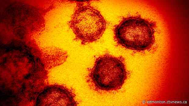 Alberta reports 29 cases of COVID-19, 2 deaths