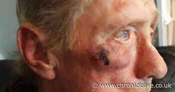 Cyclist, 63, suffers facial injuries after object thrown at him from passing car