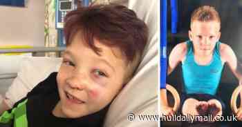 'Warrior' dancer, 9, still smiling despite losing leg in horror crash - Hull Daily Mail