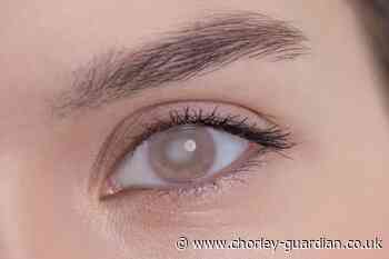 Entrepreneur asks for corneal disease support - Chorley Guardian