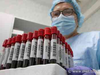 Marauding monkeys make off with coronavirus vials in India     - CNET