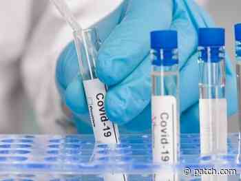 San Diego Coronavirus: 140 New Cases, 6 Deaths - San Diego, CA Patch