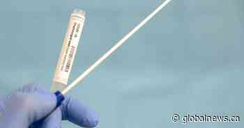 Coronavirus testing open to anyone in Ottawa as hospitalized case numbers drop - Globalnews.ca