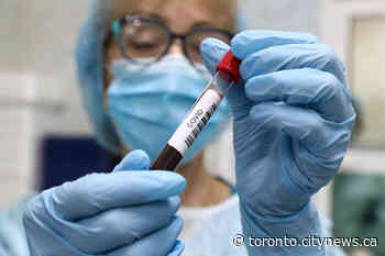 Ontario confirms 323 new COVID-19 cases, 17 more deaths - CityNews Toronto