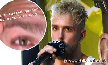 Jake Paul shares images of his 'bleeding eyes' after being tear-gassed while 'documenting' looting