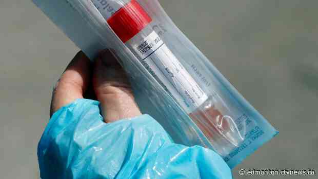 As May comes to a close, Alberta has 584 active cases of COVID-19 and 143 people have died