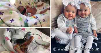 Twins born weighing 3lbs between them went home on due date - 3 months later