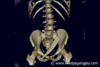 What Did This Large Piece of Glass Do to This 52-Year-Old Woman?