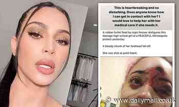 Kim Kardashian offers to pay medical bills of protester left horrifically disfigured