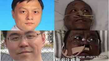Muere el médico chino que se volvió negro por el coronavirus - MARCA.com