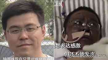 Murió uno de los médicos cuya piel se oscureció tras contraer coronavirus en China - infobae