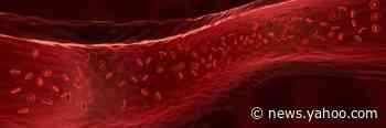 New Evidence Suggests COVID-19 May Actually Be a Blood Vessel Disease