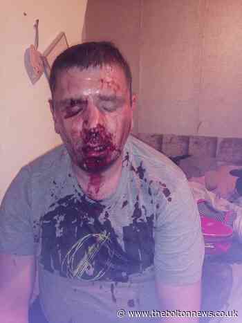 Brother makes plea after thugs left dad for dead in attack