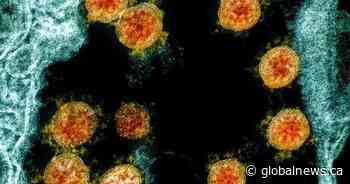 Thousands worldwide volunteer for deliberate coronavirus exposure to speed up vaccine development - Global News