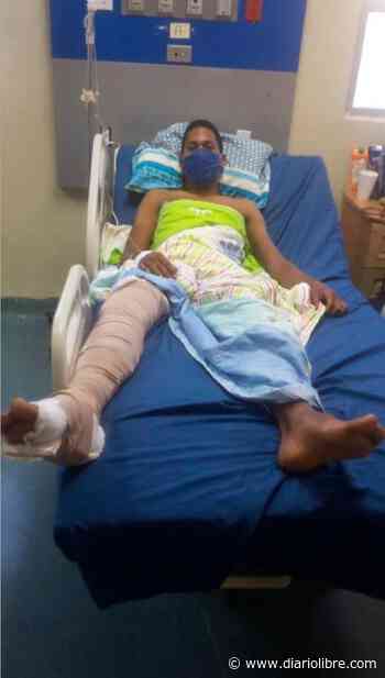 VIDEO | Joven con la pierna rota denuncia abuso policial en Santo Domingo - Diario Libre