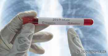 Five new coronavirus cases confirmed in Simcoe Muskoka, local total now at 486 - Globalnews.ca