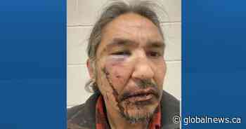Northern Alberta First Nations chief alleges he was beaten by RCMP