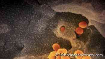 Alberta sees 40 new cases of COVID-19 infections Saturday - Lethbridge News Now