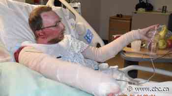 'I lost everything': Edmonton man recovers from house fire - CBC.ca