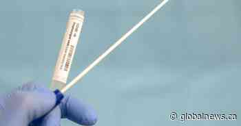 Out of 14,853 asymptomatic tests, Alberta confirms 6 positive COVID-19 cases