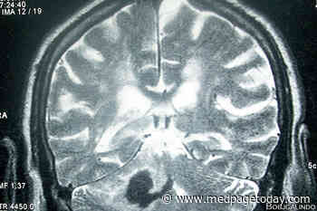 Brain Bleeds on Steady Trend Upward