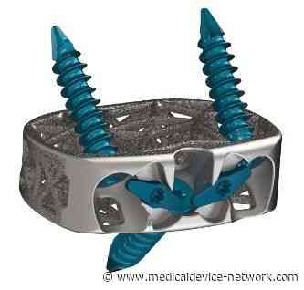 4WEB Medical receives FDA clearance for spine interbody implant - Medical Device Network