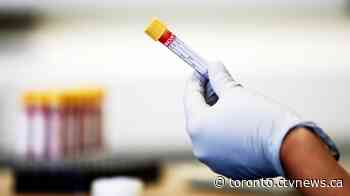 Ontario records increase of new COVID-19 cases but downward trend continues