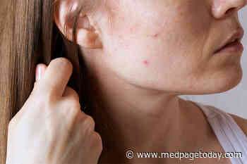 With Adult Acne, You Are What You Eat
