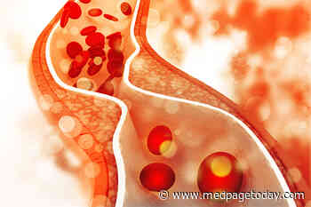 Atherosclerotic Events on the Decline in SLE