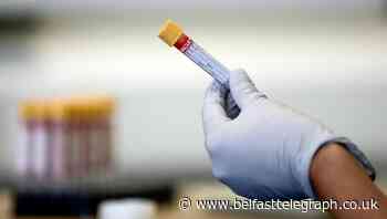 Coronavirus study finds as many as 80% of positive cases do not show symptoms
