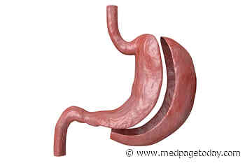 Sleeve Gastrectomy Linked With Lower Fracture Risk