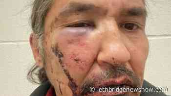 A list of police encounters being questioned and investigated in Canada - Lethbridge News Now