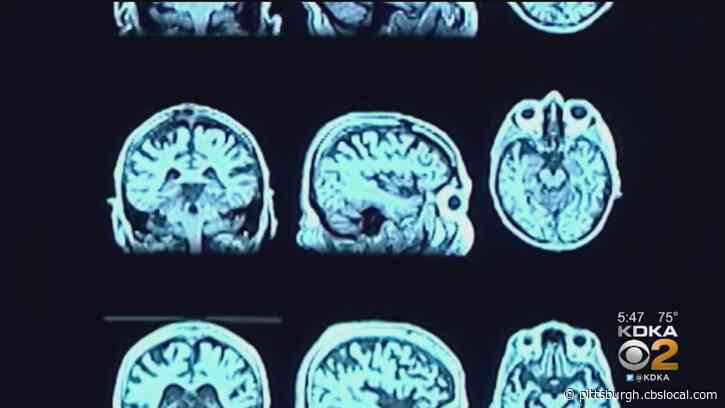 Local Doctors See Neurological Complications For Coronavirus Patients Coming Off Ventilators
