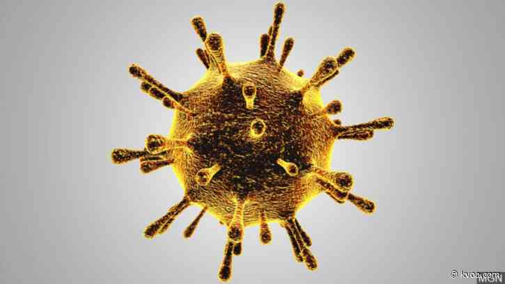 COVID-19 in Arizona: 34,458 cases, 1,183 deaths