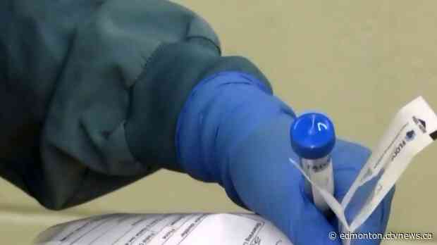 Alberta confirms 50 new cases of COVID-19 on Sunday