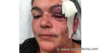 Photographer amid Minneapolis unrest sues, says officers blinded her in eye with nonlethal shot