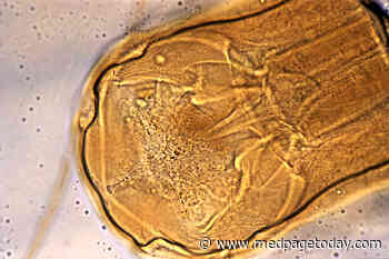 Muddy Results for MS Hookworm Therapy