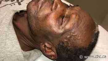 Witness video captures violent takedown of elderly Black couple at GTA hospital