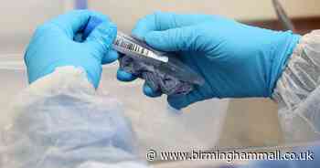 UK coronavirus death toll rises by lowest Tuesday increase since lockdown