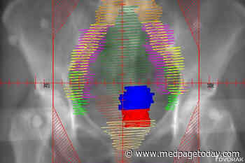 Guideline Addresses Radiotherapy for Cervical Cancer