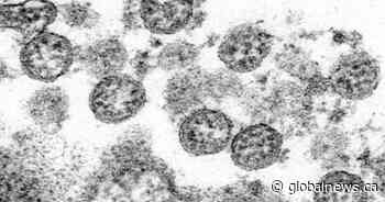 New COVID-19 outbreaks at 3 Edmonton continuing care facilities
