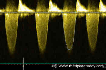 Midrange Heart Failure: Trajectory Matters