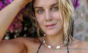 Made in Chelsea's Ashley James talks about her acne battle