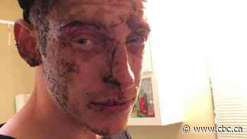 Kelowna man punched in head during arrest sues RCMP officer