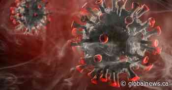 8 new coronavirus cases reported in Saskatchewan, no new recoveries