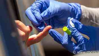 Scientists aren't waiting around for governments to launch antibody testing