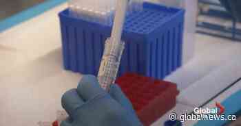 Edmonton COVID-19 trend shows jump in active cases, more young people testing positive - Globalnews.ca