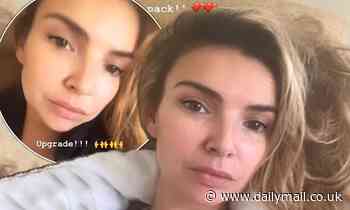 Nadine Coyle receives a freak injury to her neck after whipping her hair while dancing at home